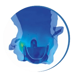 Aortic root illustration