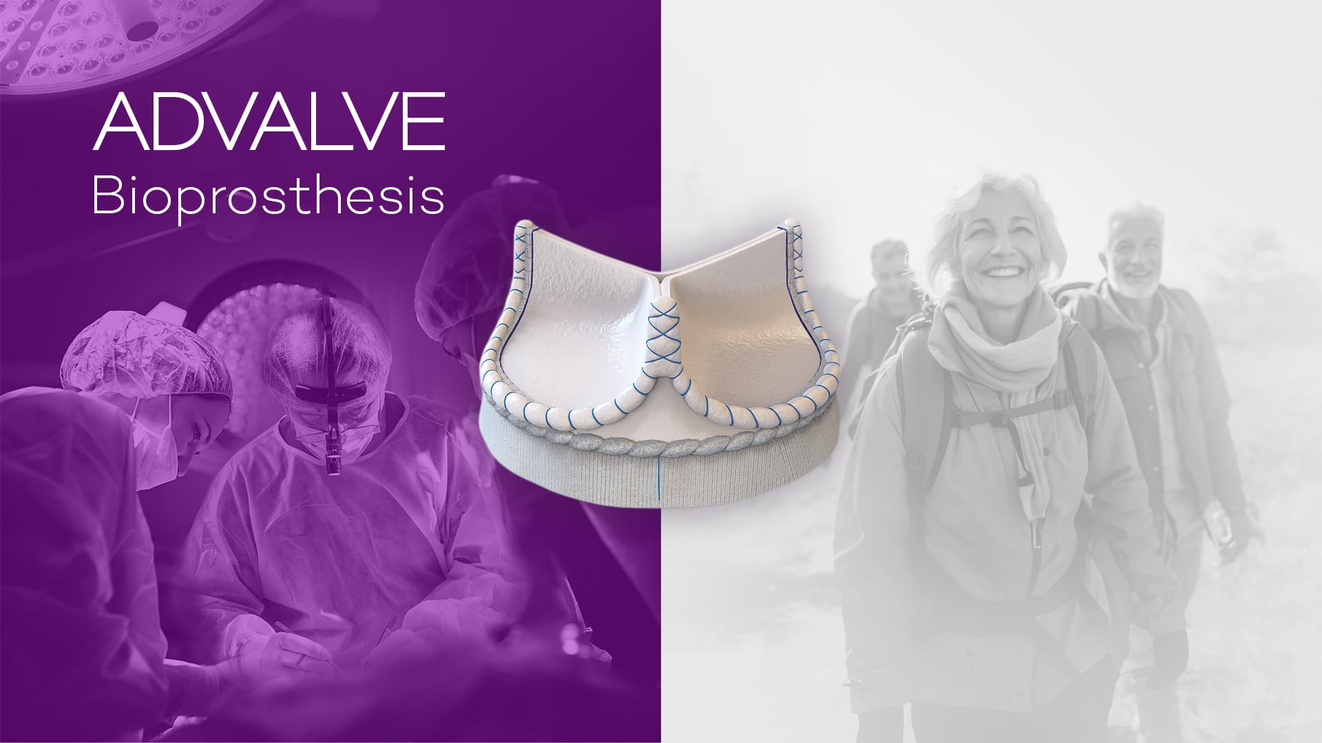 ADVALVE Biological Heart Valve Prosthesis