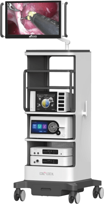Vision System Active View